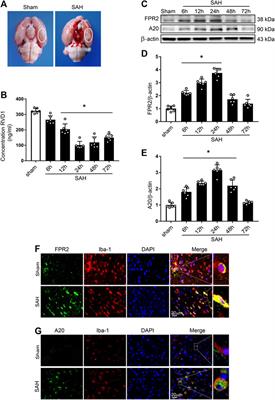 Resolvin D1 ameliorates Inflammation-Mediated Blood-Brain Barrier Disruption After Subarachnoid Hemorrhage in rats by Modulating A20 and NLRP3 Inflammasome